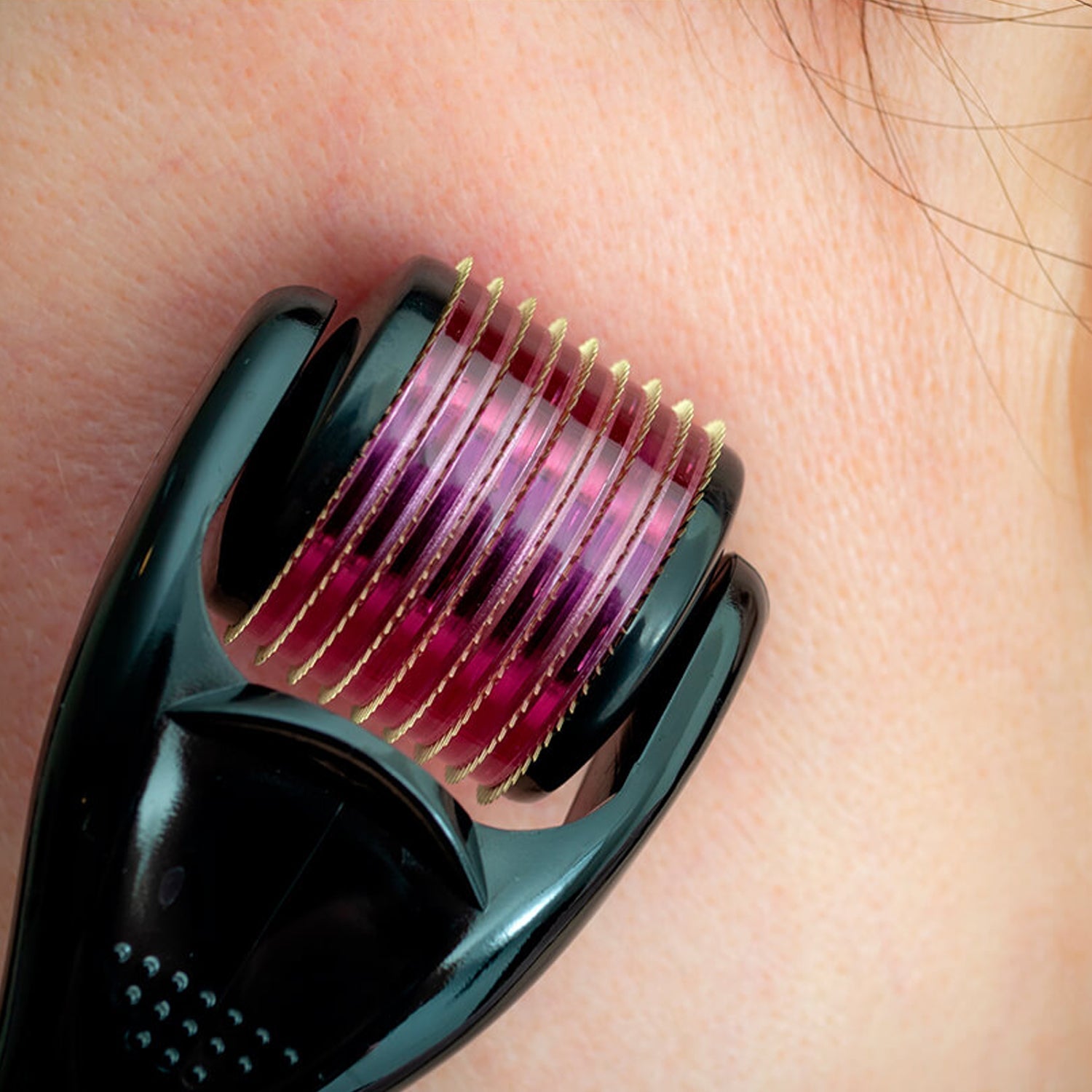 Derma roller for improving skin appearance and promoting hair growth Derma roller for improving skin appearance and promoting hair growth